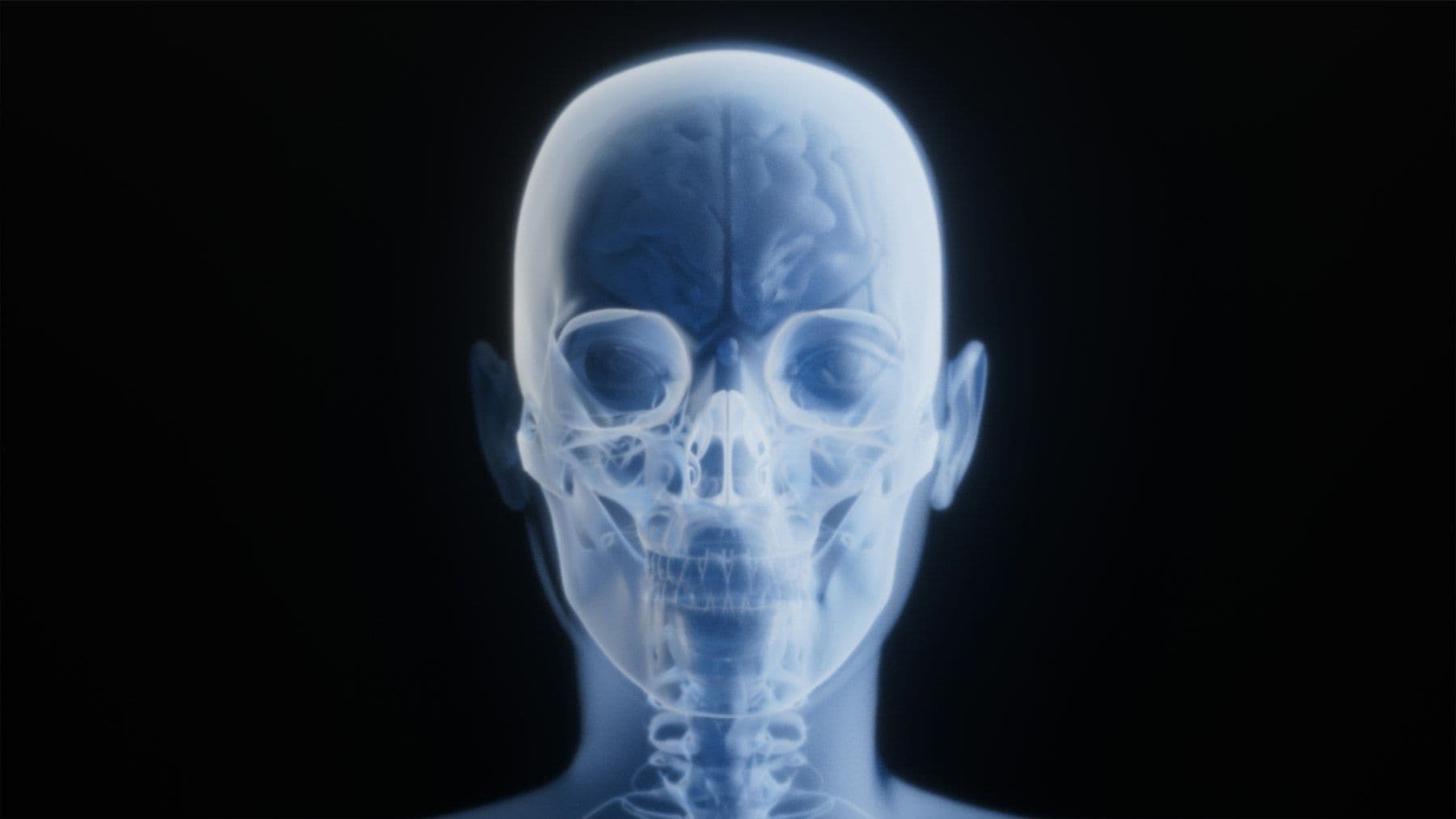 An X-ray style image of the head and neck in blue